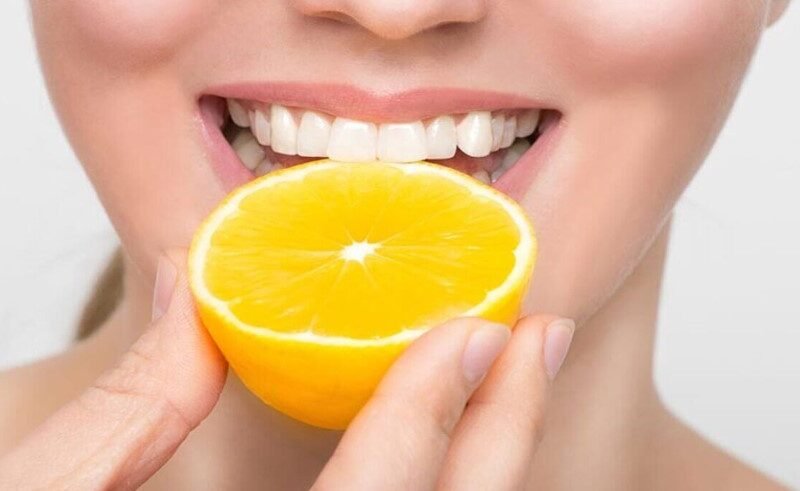 Vitamin C Foods for Gum Health