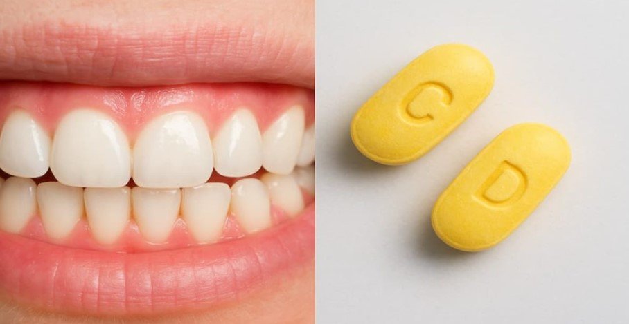 Vitamin C amount for healthy gums
