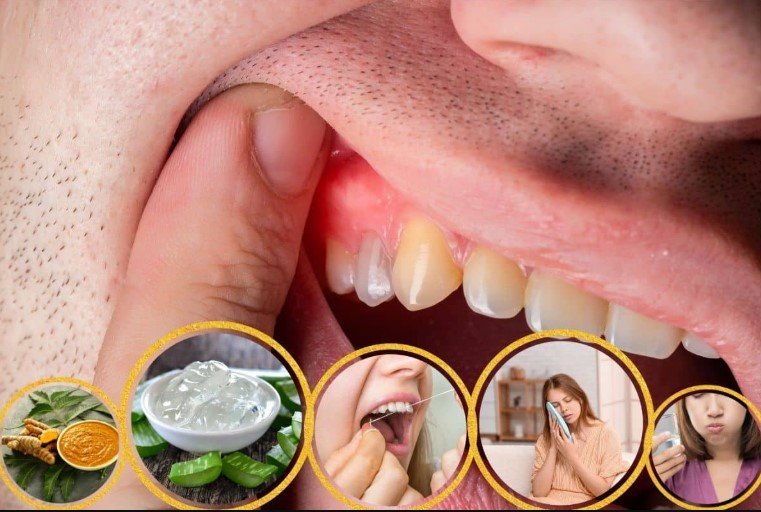 Home Care for Receding Gums